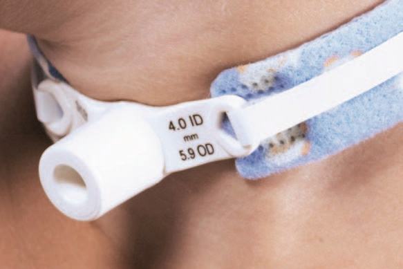 Bezpłatne badania laryngologiczne w Poznaniu